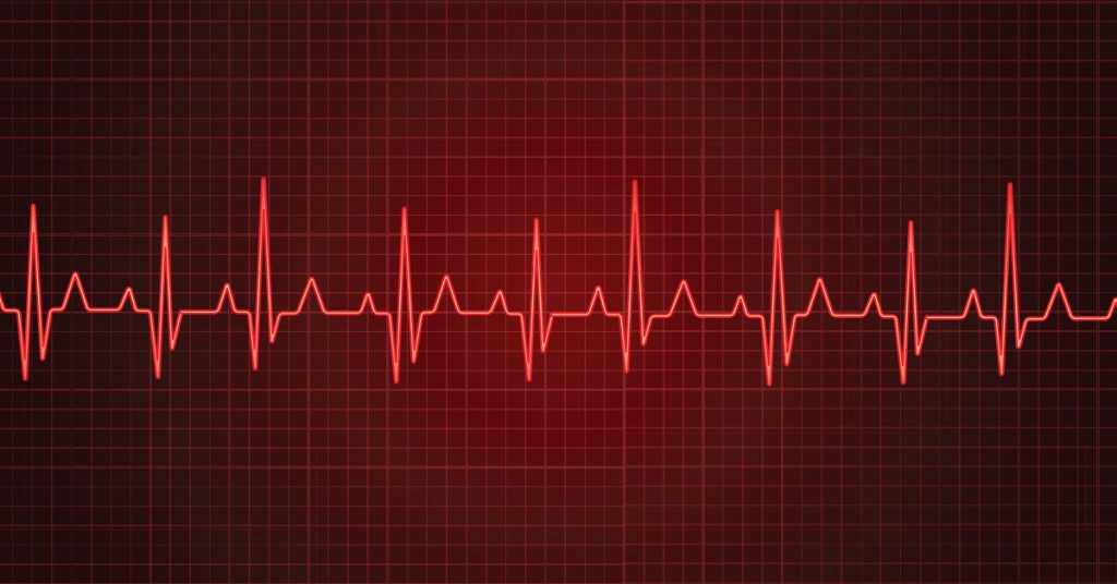 when should i be worried about an irregular heartbeat