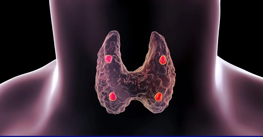 What are the signs and symptoms of parathyroid disease