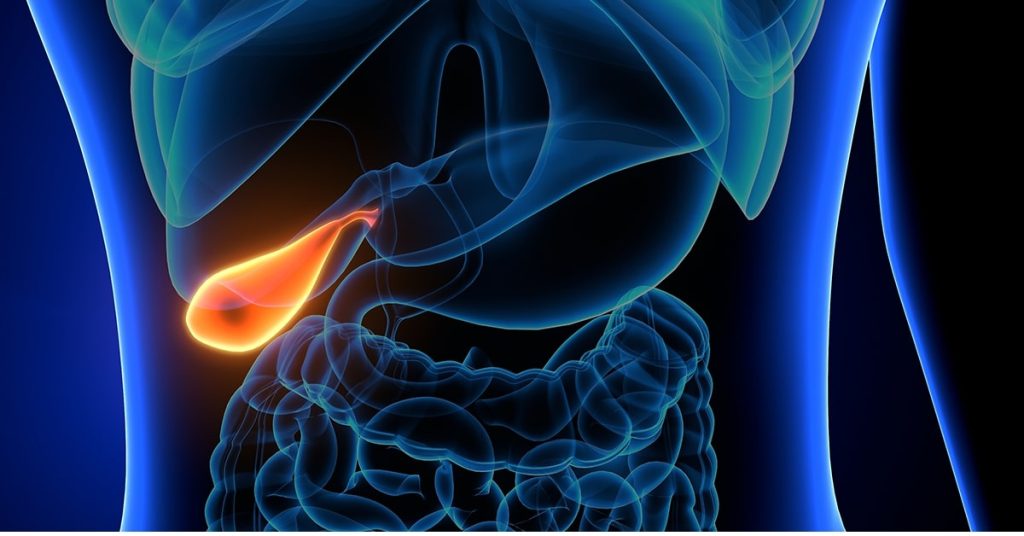 can-gallstones-cause-high-ast-and-alt-levels