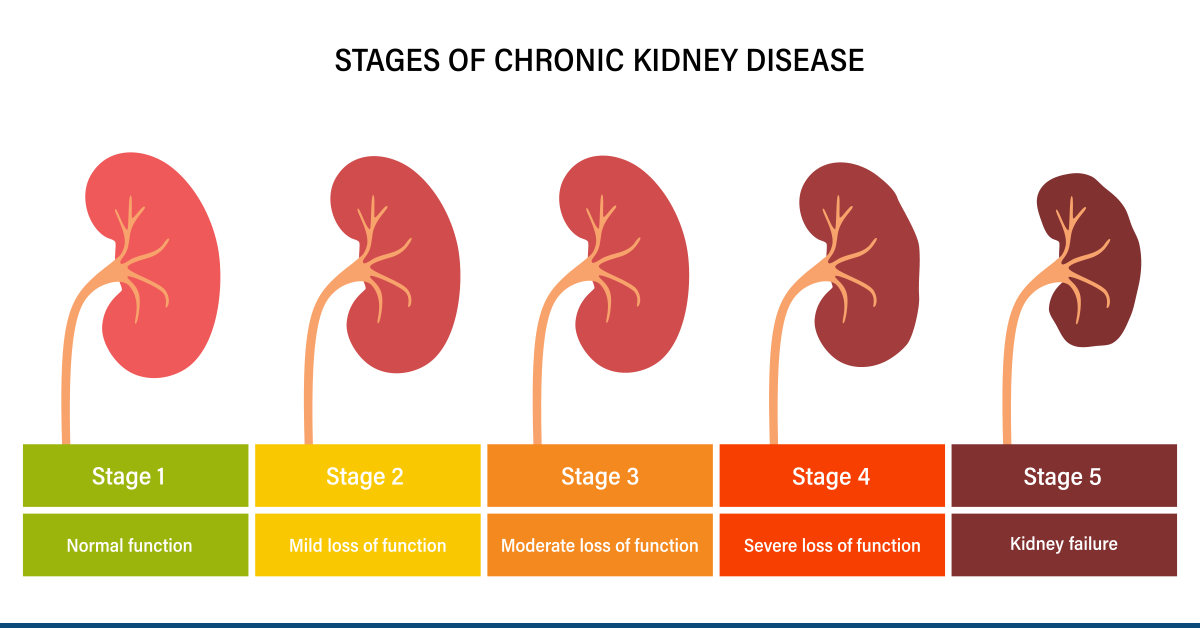 5 stages of chronic kidney disease