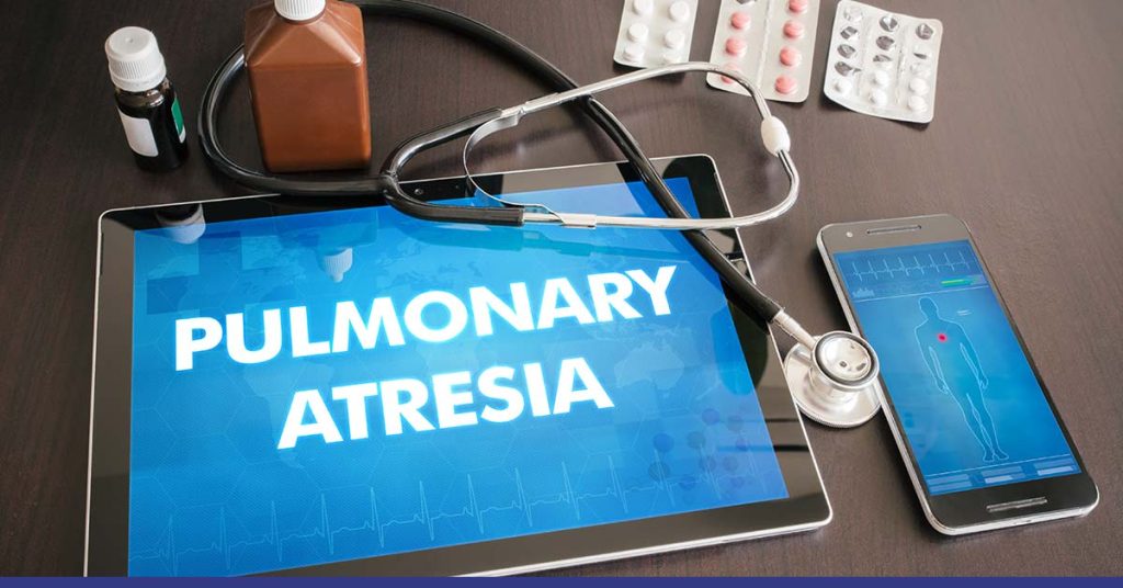 Pulmonary Atresia Diagnosis, Causes & Preventions